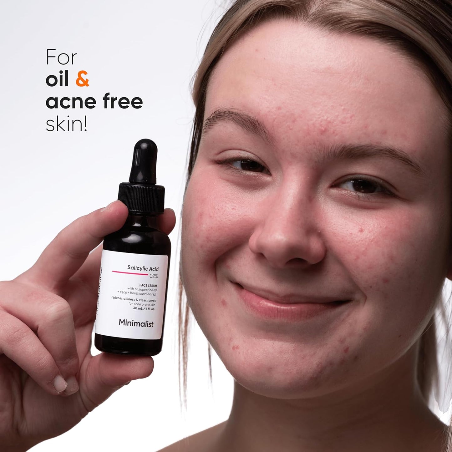 2% Salicylic Acid Serum for Acne, Blackheads & Open Pores | Reduces Excess Oil & Bumpy Texture | BHA Based Exfoliant for Acne Prone or Oily Skin, 30Ml1 Fl Oz (Pack of 1)